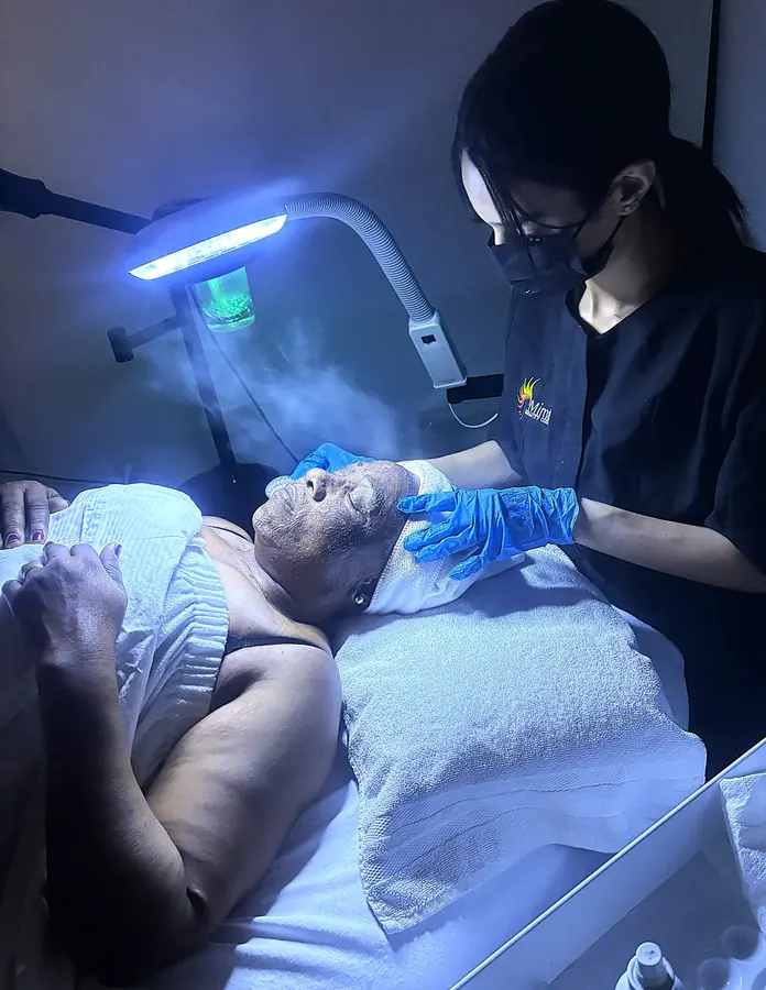 Estudiante de estética realizando un tratamiento de microneedling